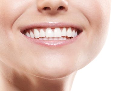 woman smiling after getting dental veneers in Chardon, OH